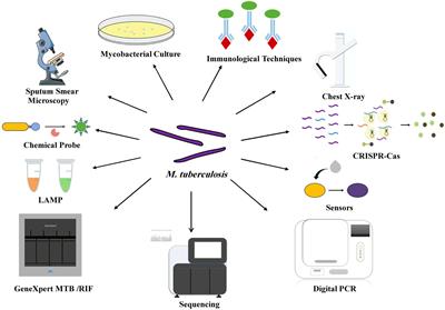 Improved Conventional and New Approaches in the Diagnosis of Tuberculosis